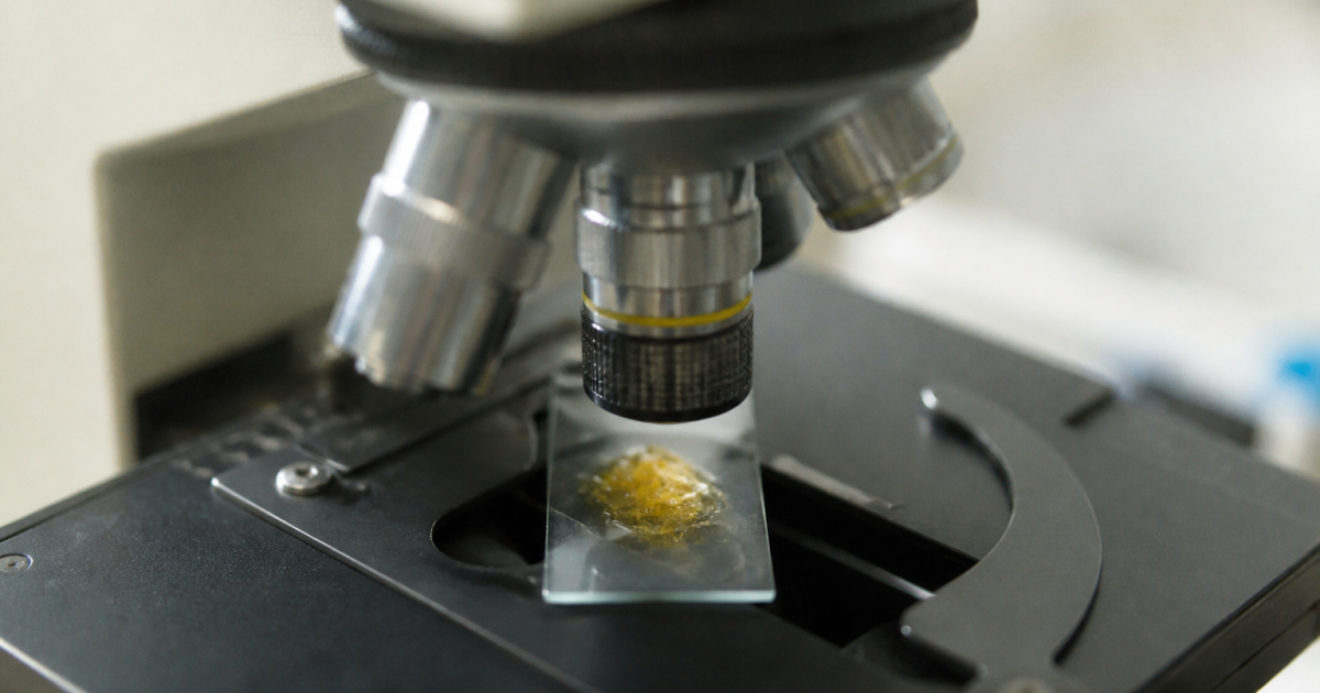 Gros plan microscope montrant particules jaunes dans echantillon selles