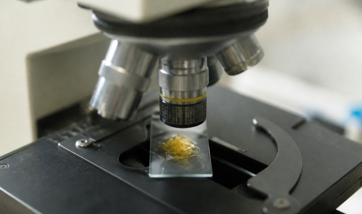 Gros plan microscope montrant particules jaunes dans echantillon selles
