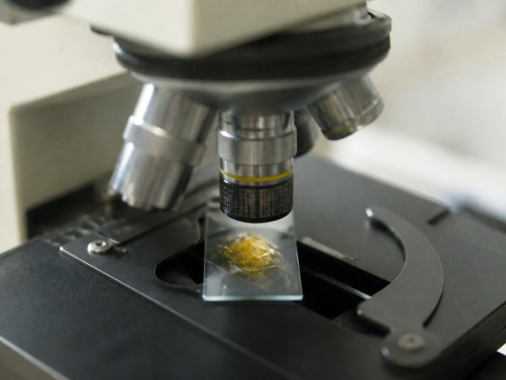 Gros plan microscope montrant particules jaunes dans echantillon selles