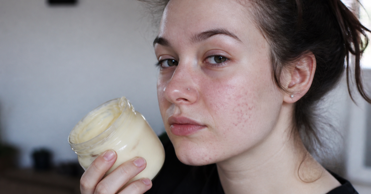 Visage de jeune femme avec acne et pot mayonnaise.