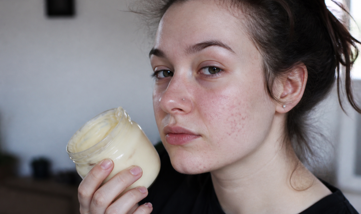 Visage de jeune femme avec acne et pot mayonnaise.