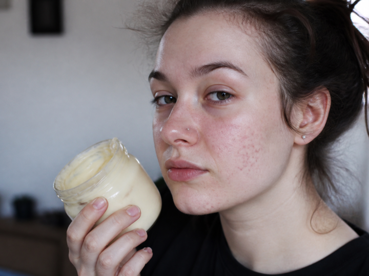 Visage de jeune femme avec acne et pot mayonnaise.