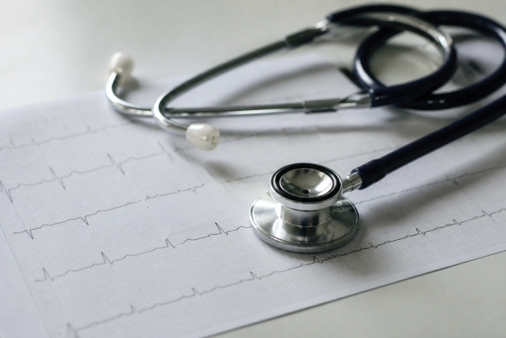 Stethoscope on medical chart showing heart rhythm patterns